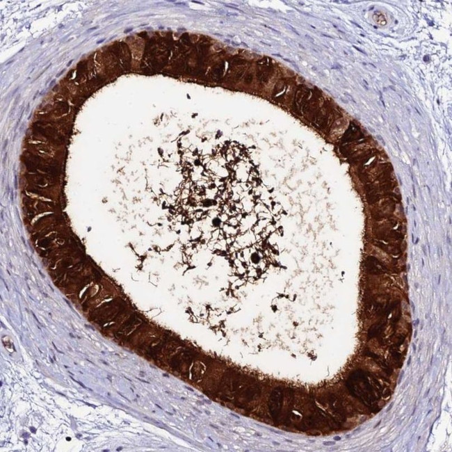 DEFB132 Antibody in Immunohistochemistry (IHC)