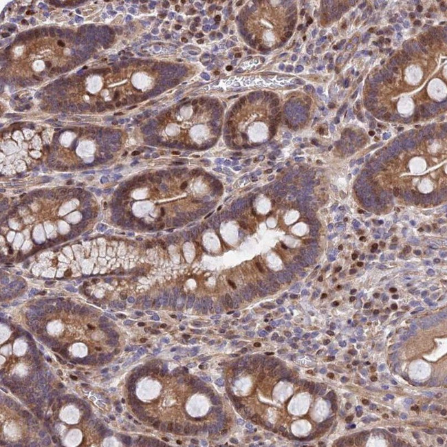 RPAP2 Antibody in Immunohistochemistry (IHC)