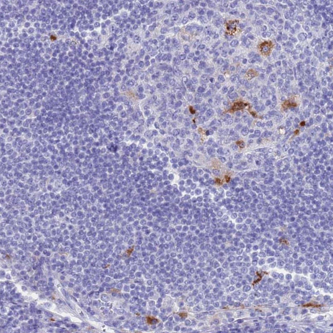 FUCA1 Antibody in Immunohistochemistry (IHC)