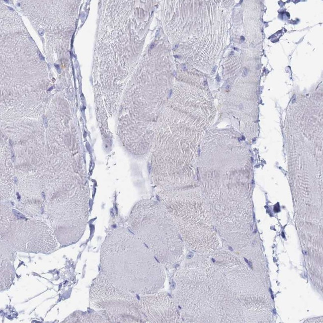 FUCA1 Antibody in Immunohistochemistry (IHC)