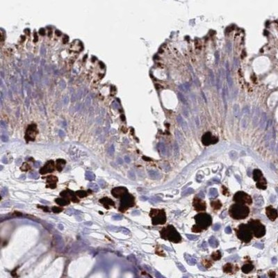 FUCA1 Antibody in Immunohistochemistry (IHC)