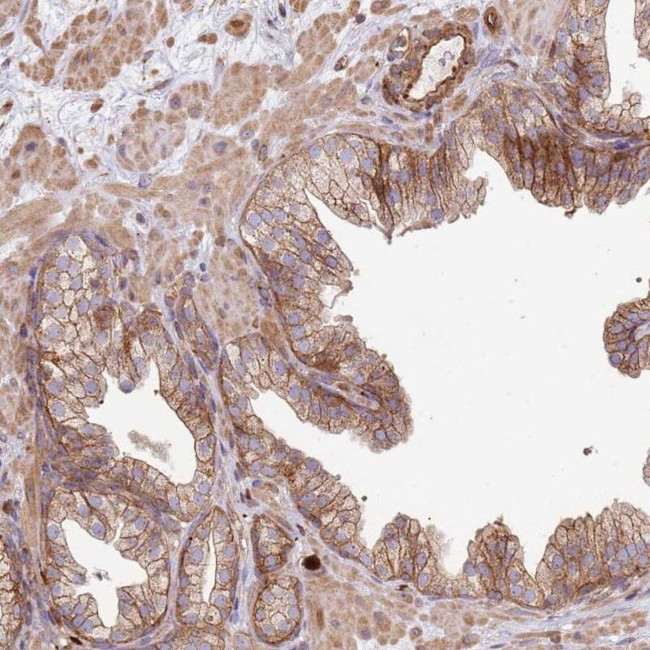 NDUFAF4 Antibody in Immunohistochemistry (IHC)