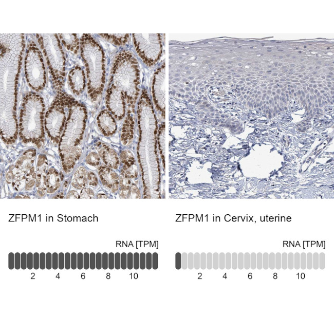 ZFPM1 Antibody in Immunohistochemistry (IHC)