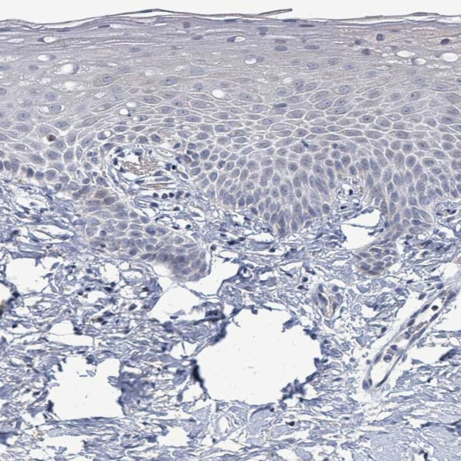 ZFPM1 Antibody in Immunohistochemistry (IHC)