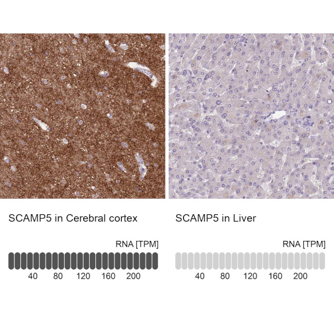 SCAMP5 Antibody in Immunohistochemistry (IHC)