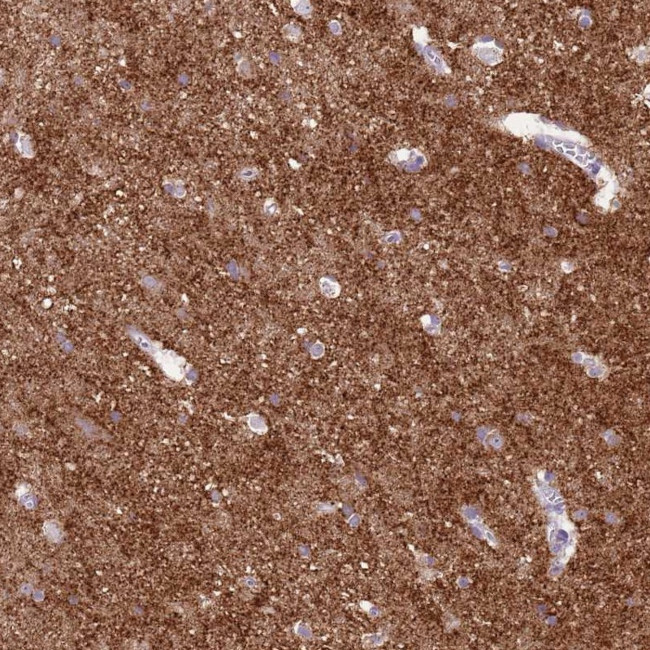 SCAMP5 Antibody in Immunohistochemistry (IHC)