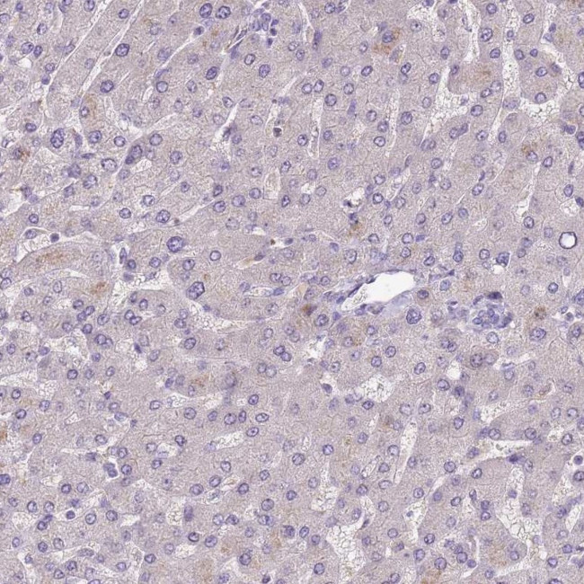 SCAMP5 Antibody in Immunohistochemistry (IHC)