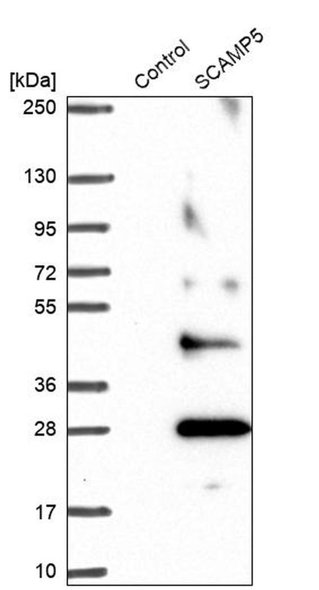 SCAMP5 Antibody in Western Blot (WB)