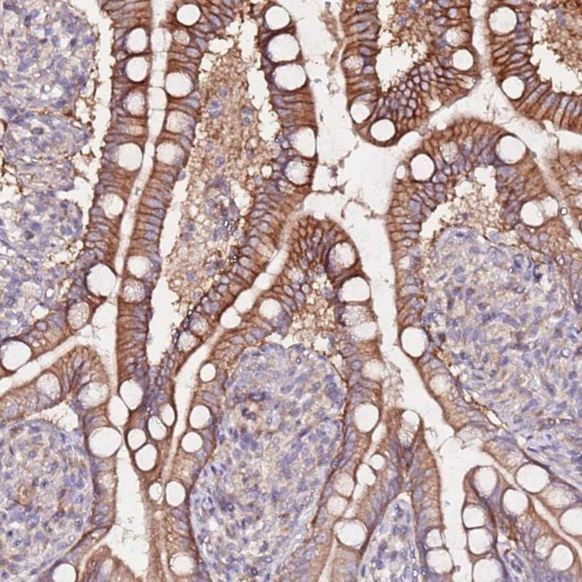 FLVCR1 Antibody in Immunohistochemistry (IHC)