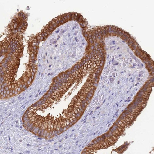 UQCRQ Antibody in Immunohistochemistry (IHC)