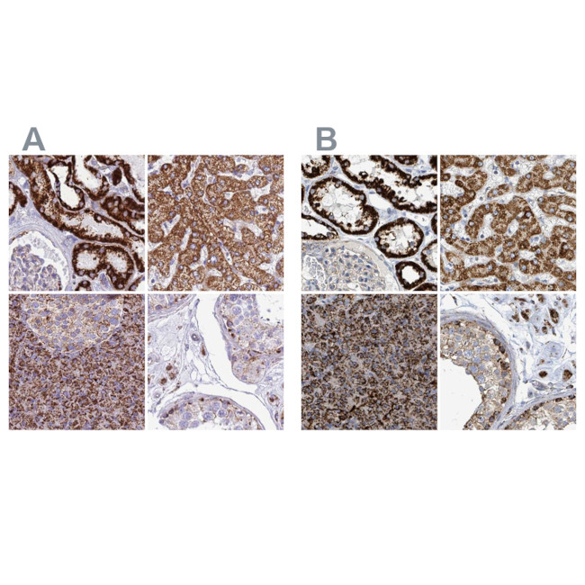 SUCLG2 Antibody in Immunohistochemistry (IHC)