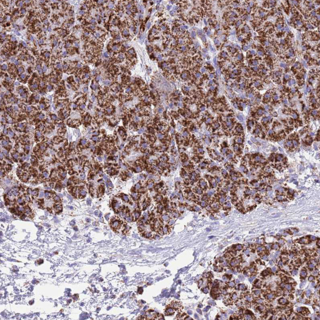 SUCLG2 Antibody in Immunohistochemistry (IHC)