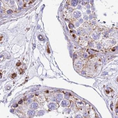 SUCLG2 Antibody in Immunohistochemistry (IHC)