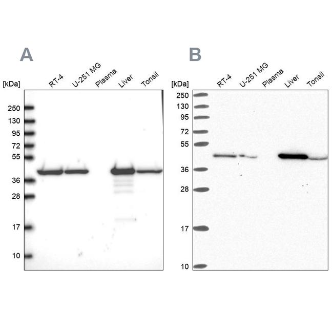 SUCLG2 Antibody in Western Blot (WB)