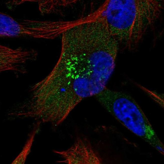 ABCB6 Antibody in Immunocytochemistry (ICC/IF)