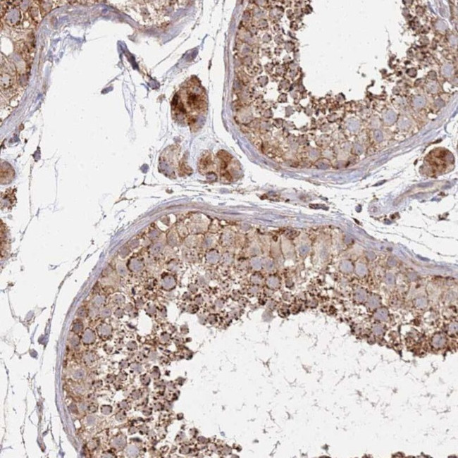 ABCB6 Antibody in Immunohistochemistry (IHC)