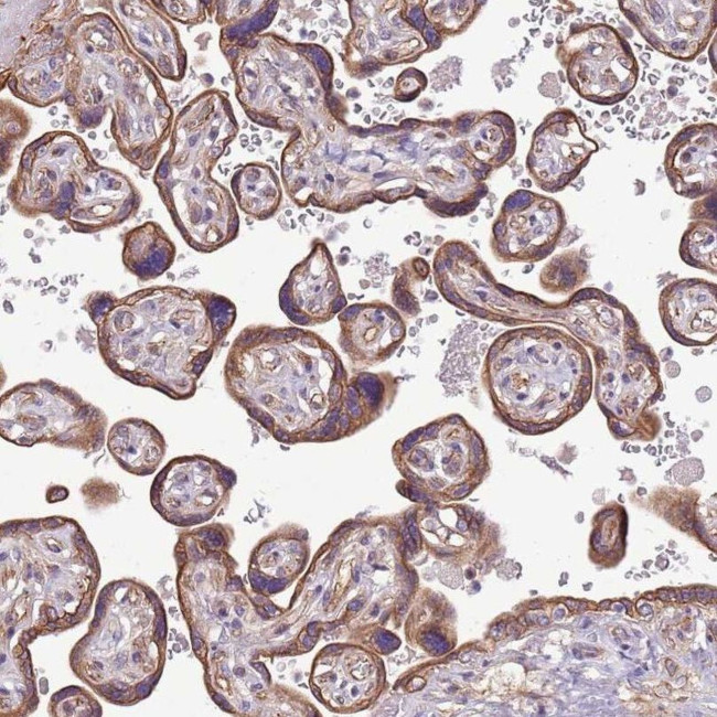 KIAA1033 Antibody in Immunohistochemistry (IHC)