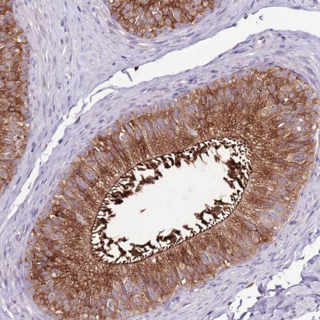 ZSWIM1 Antibody in Immunohistochemistry (IHC)