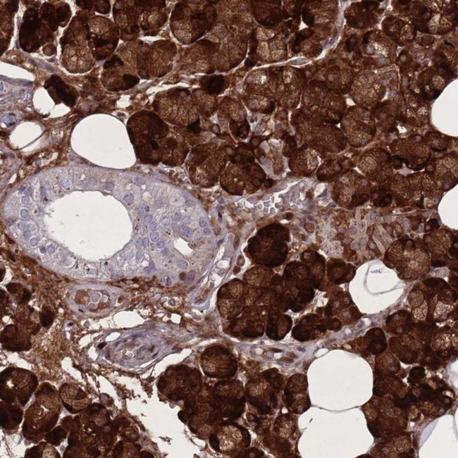 PAIP2B Antibody in Immunohistochemistry (IHC)