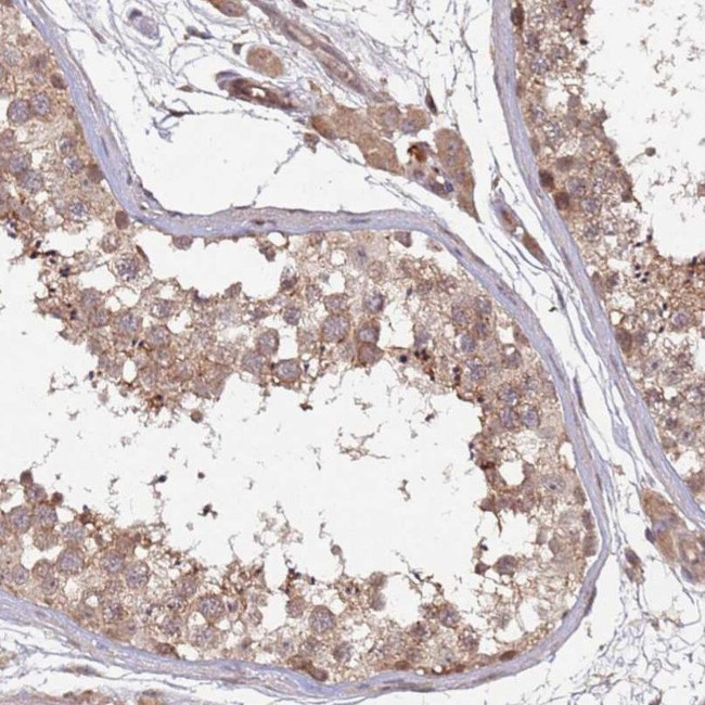 KANSL1L Antibody in Immunohistochemistry (IHC)