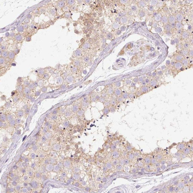 PRRC2A Antibody in Immunohistochemistry (IHC)