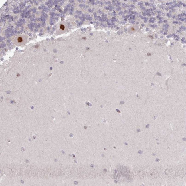 KBTBD6 Antibody in Immunohistochemistry (IHC)