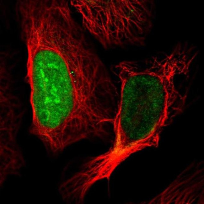 CT45A Antibody in Immunocytochemistry (ICC/IF)