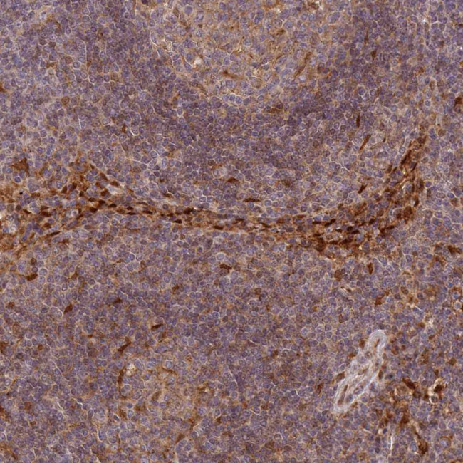 LGALS9B Antibody in Immunohistochemistry (IHC)