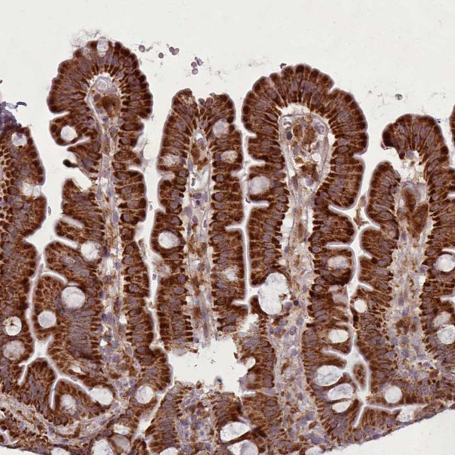 LGALS9B Antibody in Immunohistochemistry (IHC)