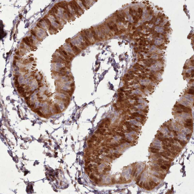 LGALS9B Antibody in Immunohistochemistry (IHC)