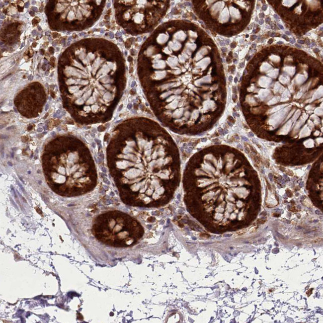 LGALS9B Antibody in Immunohistochemistry (IHC)