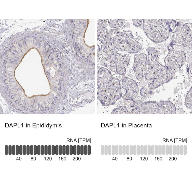 DAPL1 Antibody in Immunohistochemistry (IHC)