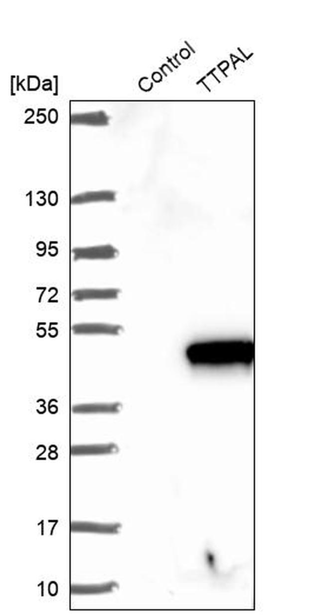 TTPAL Antibody in Western Blot (WB)