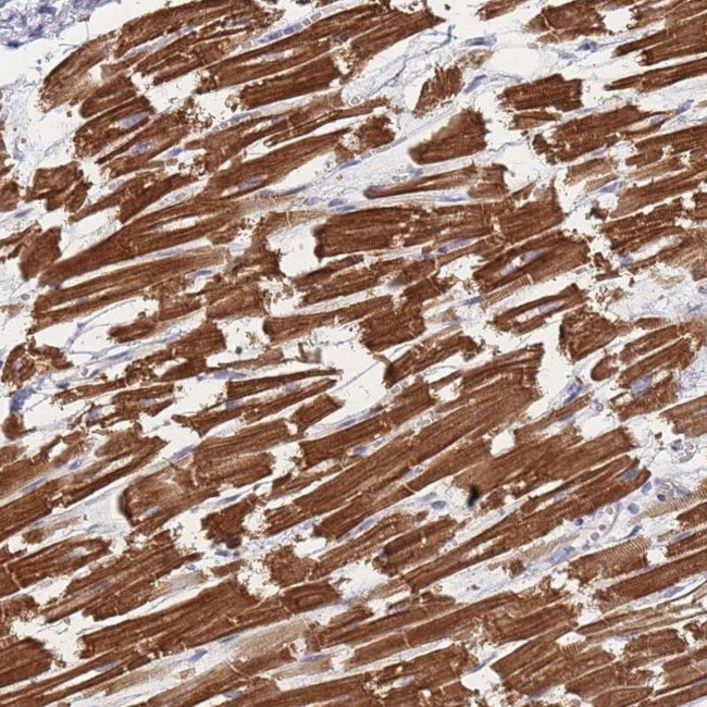 HAP40 Antibody in Immunohistochemistry (IHC)