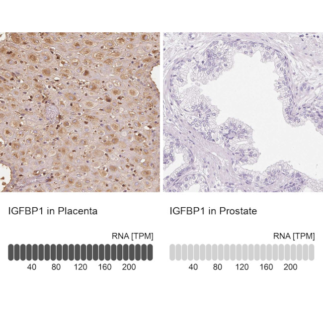 IGFBP-1 Antibody in Immunohistochemistry (IHC)