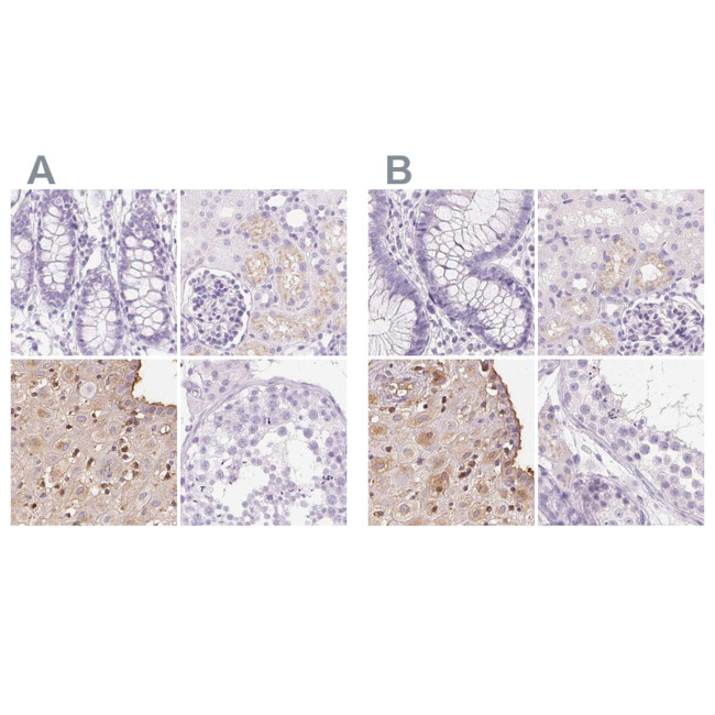 IGFBP-1 Antibody in Immunohistochemistry (IHC)