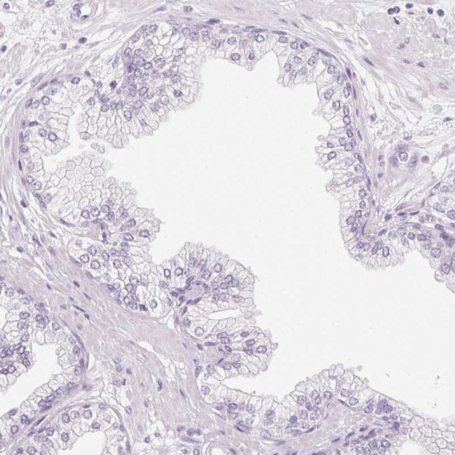 IGFBP-1 Antibody in Immunohistochemistry (IHC)