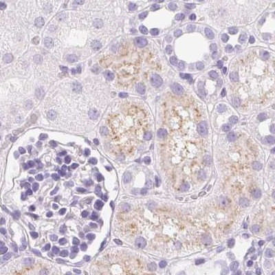 IGFBP-1 Antibody in Immunohistochemistry (IHC)