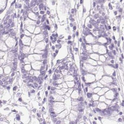 IGFBP-1 Antibody in Immunohistochemistry (IHC)