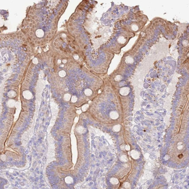 SLC44A4 Antibody in Immunohistochemistry (IHC)