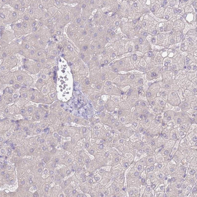 SLC44A4 Antibody in Immunohistochemistry (IHC)