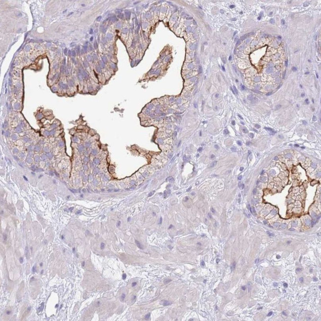 SLC44A4 Antibody in Immunohistochemistry (IHC)