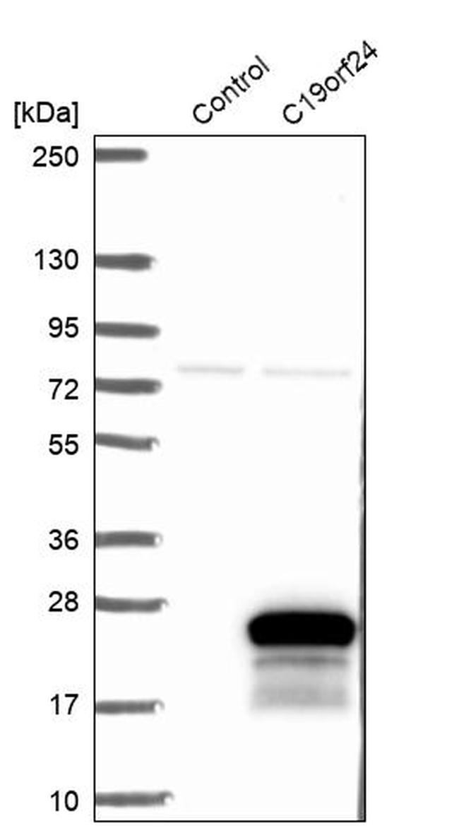 C19orf24 Antibody in Western Blot (WB)