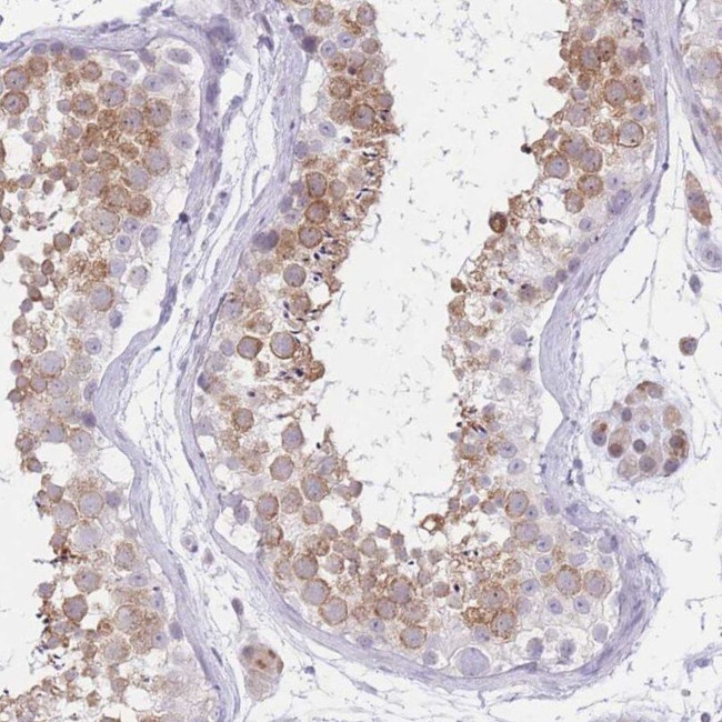 RPL39 Antibody in Immunohistochemistry (IHC)