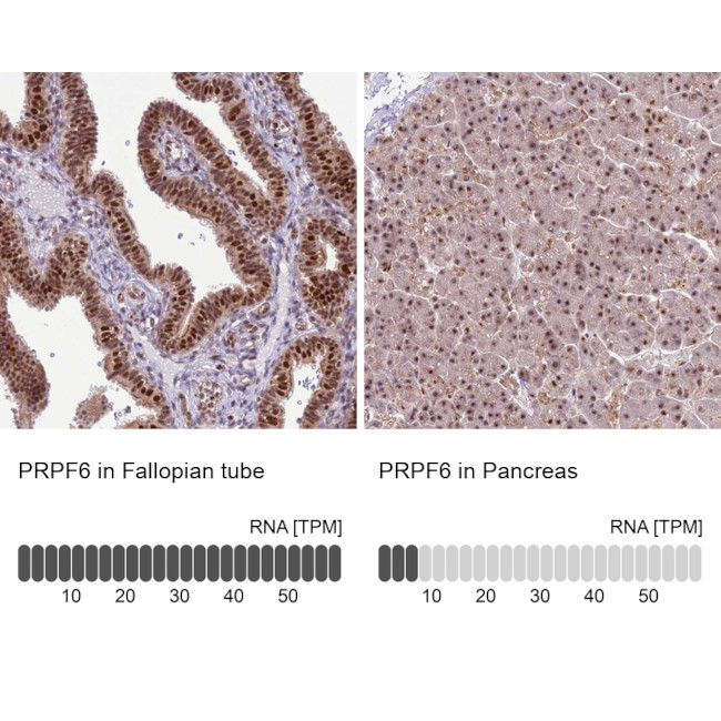 PRP6 Antibody in Immunohistochemistry (IHC)