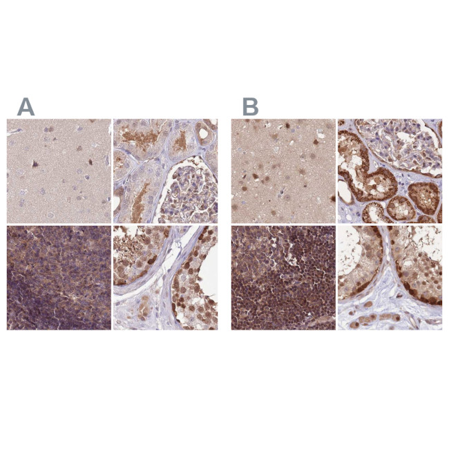 NSFL1C Antibody in Immunohistochemistry (IHC)