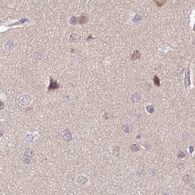 NSFL1C Antibody in Immunohistochemistry (IHC)