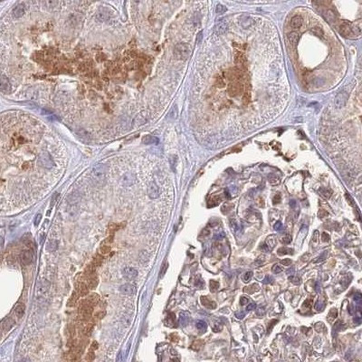 NSFL1C Antibody in Immunohistochemistry (IHC)