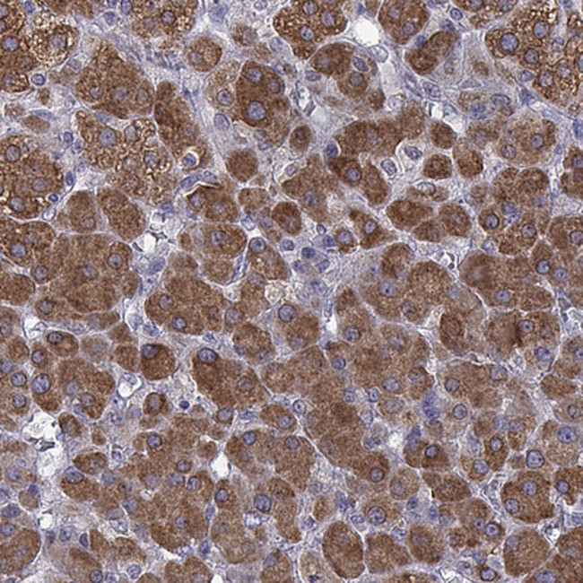 SOAT1 Antibody in Immunohistochemistry (IHC)