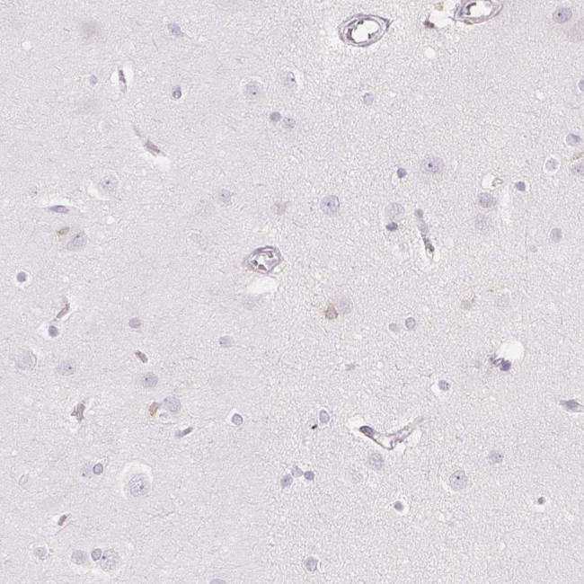 SOAT1 Antibody in Immunohistochemistry (IHC)